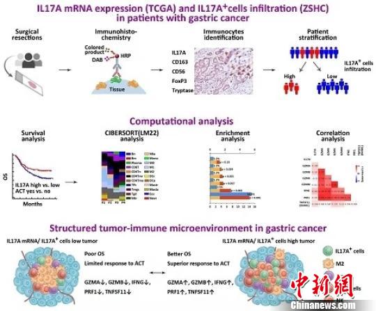 中国科学家发现胃癌微环境抗肿瘤免疫机制