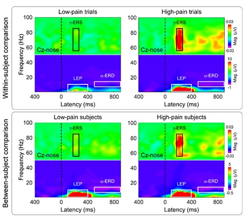 γ-ERS reflected.jpg